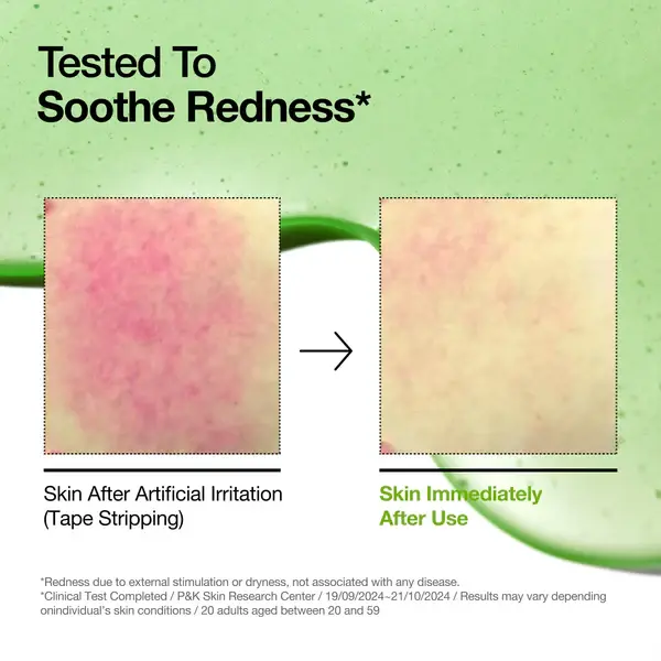 anua-us-ampoule-serum-azelaic-acid-10-hyaluron-redness-soothing-serum-1161173133.webp
