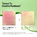 anua-us-ampoule-serum-azelaic-acid-10-hyaluron-redness-soothing-serum-1161173133.webp
