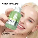 anua-us-ampoule-serum-azelaic-acid-10-hyaluron-redness-soothing-serum-1161173128.webp