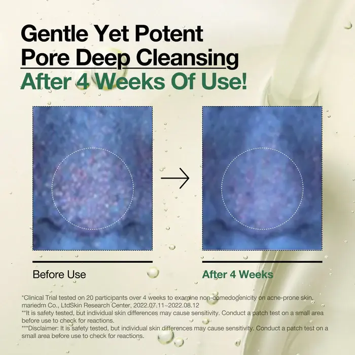 anua-us-cleanser-200ml-heartleaf-pore-control-cleansing-oil-1161173146.webp