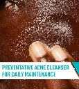 Acne-Control-Cleanser-apply-desktop-700x785-v1.webp